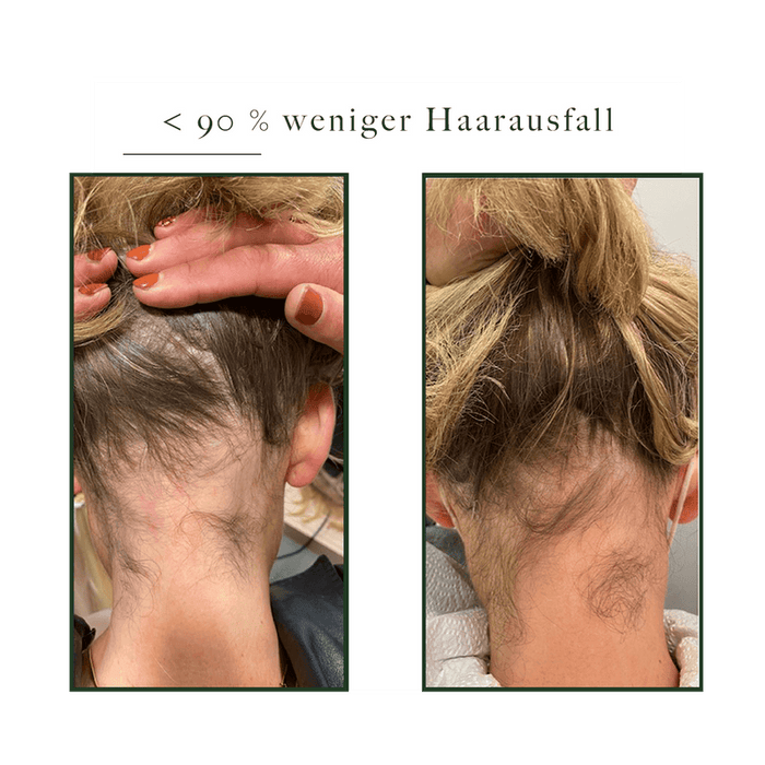 Discontinued - Hair Activator | Natucain