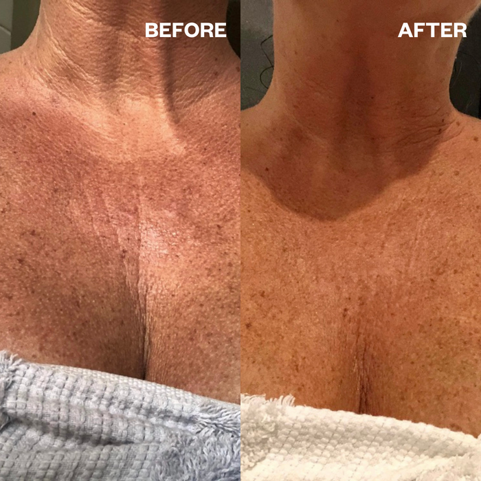 DISCONTINUED - InfuseFAST Decolletage Bicellulose Sheet Mask - single mask | Wrinkles Schminkles