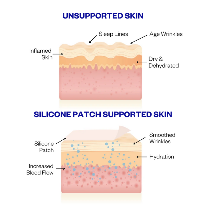 Forehead Wrinkle Patches - 2 Patches | Wrinkles Schminkles