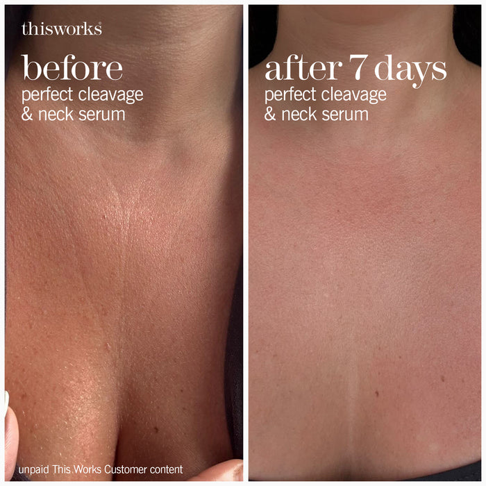 PCNS red light therapy neck duo - bundle